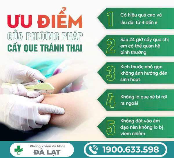 Hình ảnh minh họa